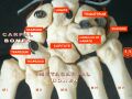 Image of the carpal bones