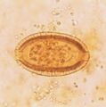 Capillaria philippinensis egg