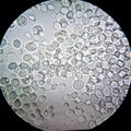 Saccharomyces
