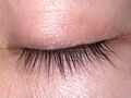 Closed human eye, superior view