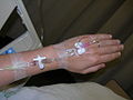 Intravenous therapy in Singapore