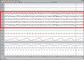 EEG recording of Stage 1 sleep