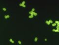 Streptococcus pneumoniae under a microscope