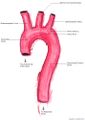 Schematic of the thoracic aorta, showing major branches