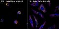 Fluorescence in situ hybridization