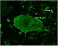 Stiff man syndrome in human cerebellum