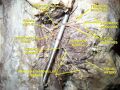 Facial nerve