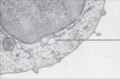 Labeled diagram of endoplasmic reticulum