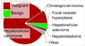 Liver tumor types in adults by relative incidence