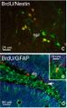 Proliferating cells in the dentate gyrus