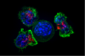Killer T cells surround a cancer cell