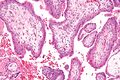 Chorionic villi - high magnification