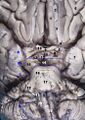 Anterior view of the human brainstem