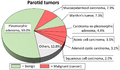Relative incidence of parotid tumors.