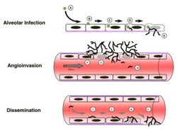 Aspergillus fumigatus Invasive Disease Mechanism Diagram