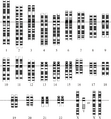 Karyotype