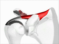 Shoulder motion with rotator cuff (supraspinatus)
