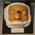 Moulage