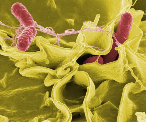 Salmonella NIAID