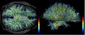 White matter