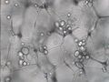 Solanum tuberosum tissue