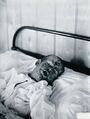 Child affected by the Gloucester smallpox epidemic, 1896