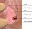 Diagram of Skene's gland