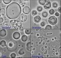 Four common forms of Blastocystis hominis