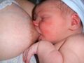 Poor breastfeeding latch