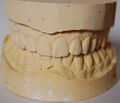 Tooth mold