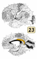 Brodmann area 23 cytoarchitectonics