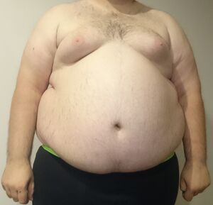 Central Obesity 008.jpg