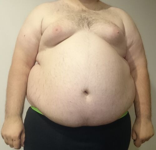 Central Obesity