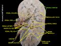Kidney Slide 24