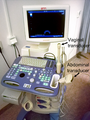 Transvaginal Ultrasonography Device