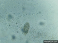 Paramecium eating bacteria