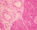 Histological section of the parotid gland