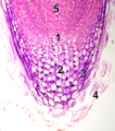 Root tip