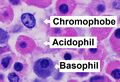 Histology of pars distalis of the anterior pituitary