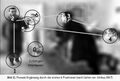 Eye movement