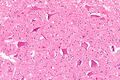 Central chromatolysis - intermediate magnification