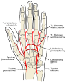 Palm of left hand