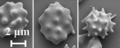 Scanning electron microscopy (SEM) of echinocytes