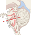 Sagittal section of the brain stem