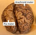 Brain with arachnoid and pia mater