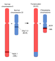 Schematic of the Philadelphia Chromosome