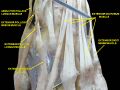 Extensor digiti minimi muscle