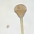Apophysomyces variabilis