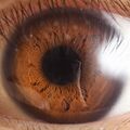 Iris (anatomy)