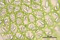 Nardia scalaris Blattzellen